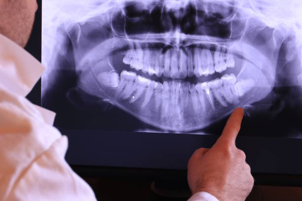 Best Emergency Root Canal Treatment in Walnut Creek, NC