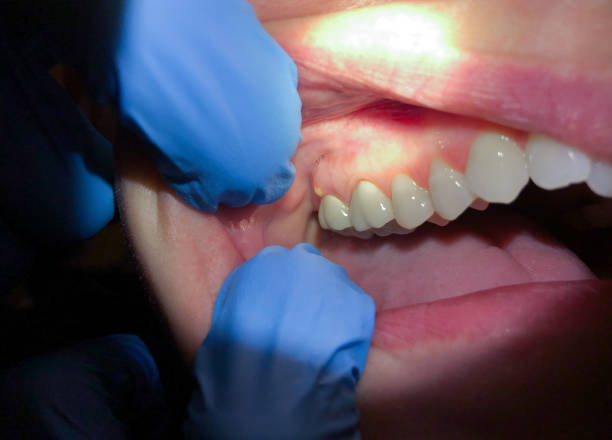Best After-Hours Dental Trauma Care in Walnut Creek, NC