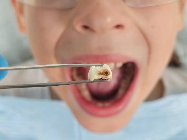 Best Same-Day Emergency Dental Services in Walnut Creek, NC